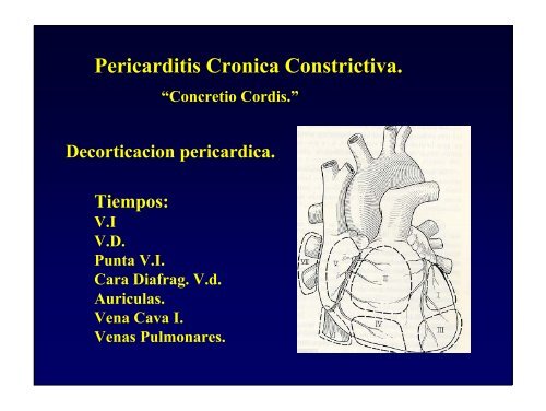 Pericardio.