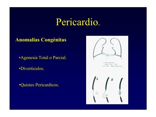 Pericardio.