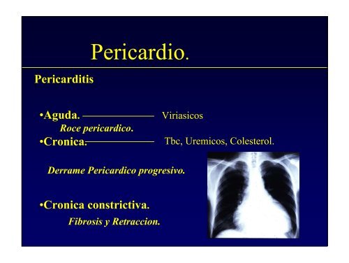 Pericardio.