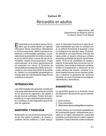 Pericarditis en Adultos