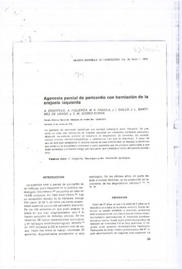 Agenesia parcial de pericardio con herniación de la orejuela izquierda