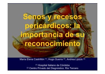 Senos y recesos pericárdicos: la importancia de su ... - SORDIC