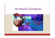 Arritmias Cardíacas