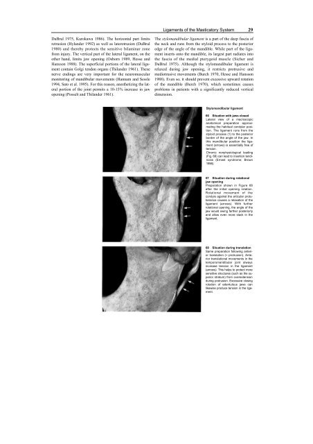 TMJ Disorders and Orofacial.pdf - E-Lib FK UWKS