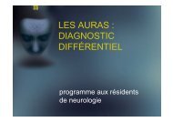 LES AURAS : DIAGNOSTIC DIFFÉRENTIEL - Chumneurologie.org