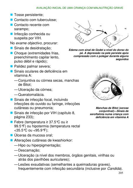 Cuidados hospitalares para crianças - ICHRC