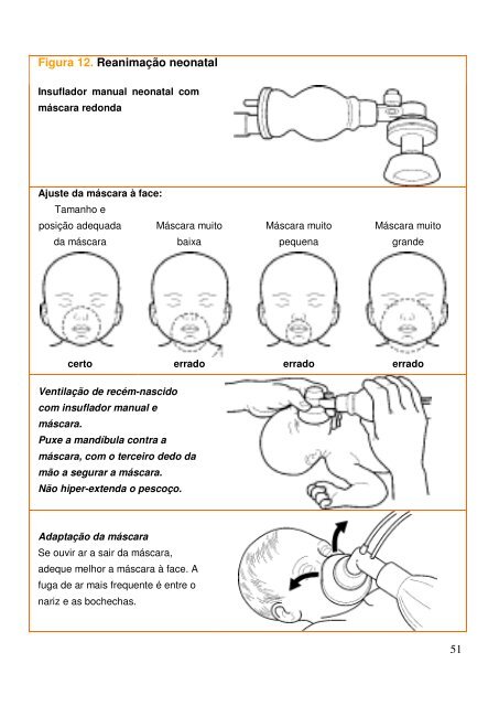 Cuidados hospitalares para crianças - ICHRC