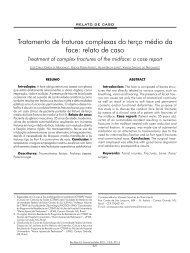 Tratamento de fraturas complexas do terço médio da face - NHU ...