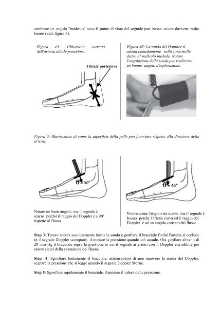 Diagnosi e gestione dell'arteriopatia periferica - Evidence-Based ...