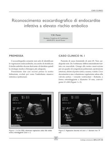 Riconoscimento ecocardiografico di endocardite infettiva a elevato ...