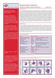 Mononucleosi infettiva - mqzh