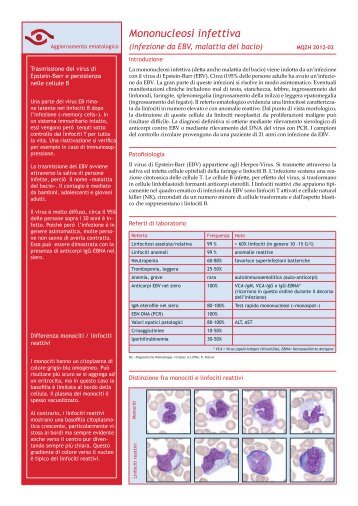 Mononucleosi infettiva - mqzh