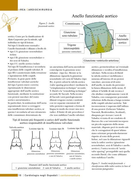 Cardiologia negli Ospedali n° 191 Gennaio / Febbraio 2013 - Anmco