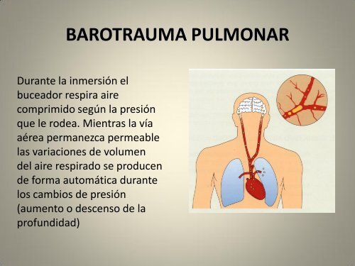 prevención y actuación en accidentes subacuáticos - Robotica ...