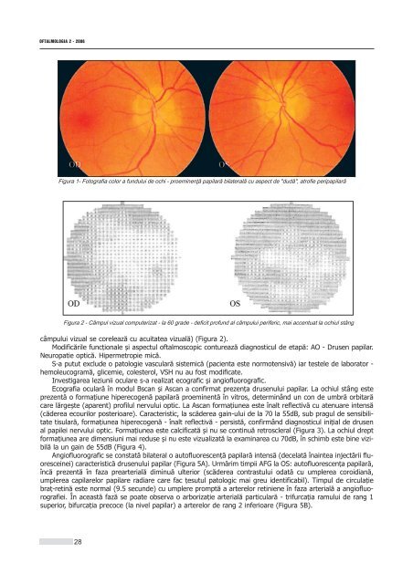 Interior 2_2006.qxd - Oftalmologia.ro