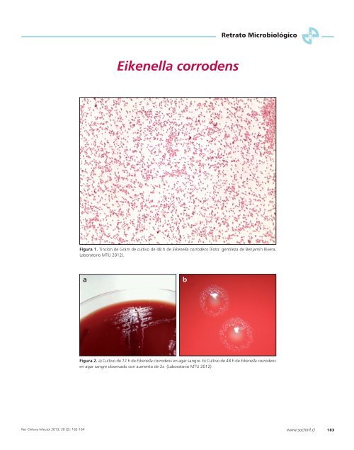 Eikenella corrodens