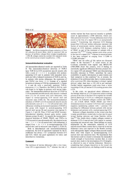 Terapia prechirurgica della fibromatosi uterina - FedOA - Università ...