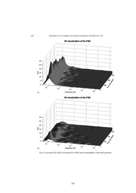 Terapia prechirurgica della fibromatosi uterina - FedOA - Università ...