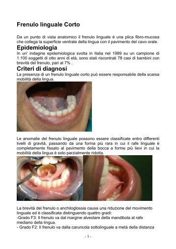 frenulo linguale corto e bisturi a risonanza quantica molecolare