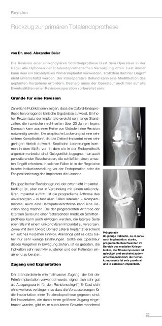 Oxford-Knie - Biomet