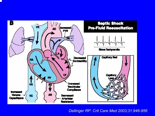 Piccinni (PDF) - Fresenius Medical Care