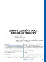 Dermatite seborréica: causas, diagnósticos e tratamento