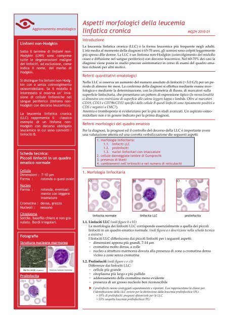 Aspetti morfologici della leucemia linfatica cronica - mqzh