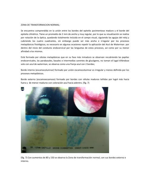 microcolpohisteroscopia, tecnica para el diagnostico temprano del ...