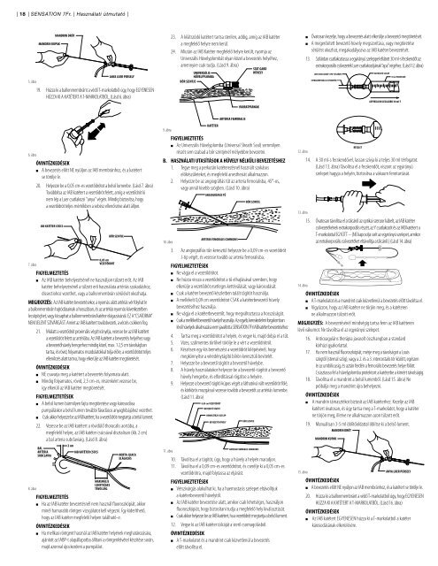 SENSATION® 7Fr. IAB CATHETER INSTRUCTIONS FOR USE