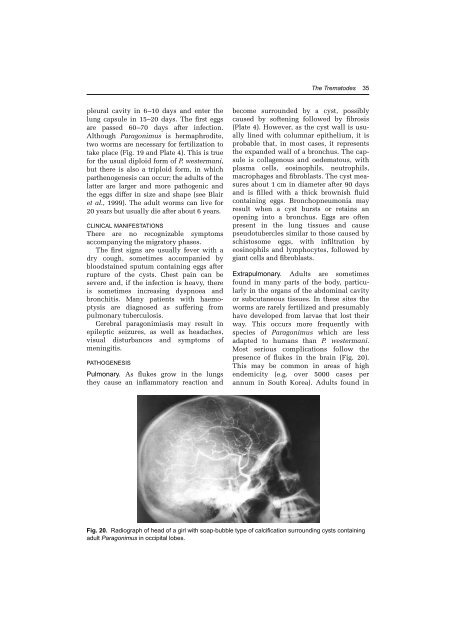 Worms and Human Disease