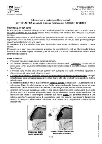 SETTOPLASTICA (associata o meno a riduzione dei TURBINATI ...