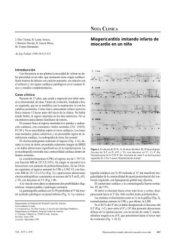 Miopericarditis imitando infarto de miocardio en un niño