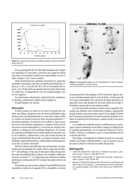 Miopericarditis imitando infarto de miocardio en un niño