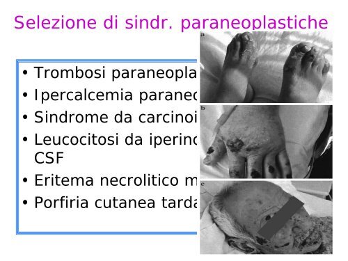 Presentazione clinica dei tumori delle vie biliari - ITMO