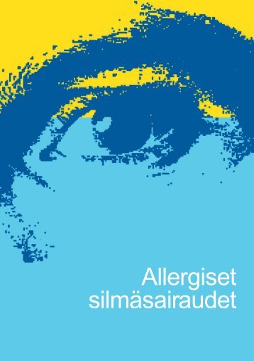Lataa itsellesi Allergiset silmäsairaudet PDF-muodossa - Optokari Oy