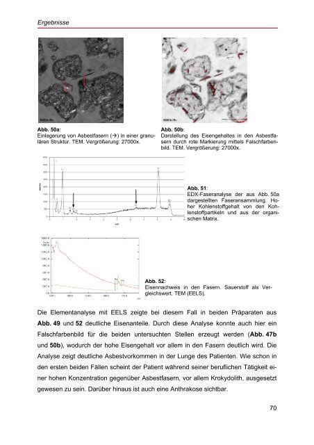 Elektronenmikroskopische Untersuchungen an Probenmaterial von ...