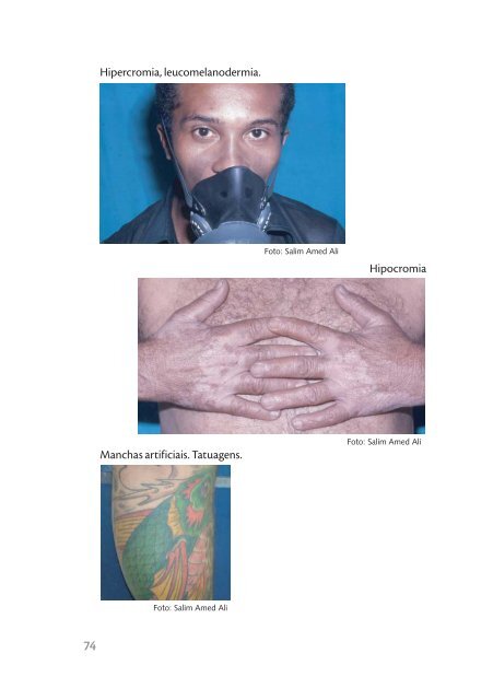 Dermatoses ocupacionais, 2006. - BVS Ministério da Saúde