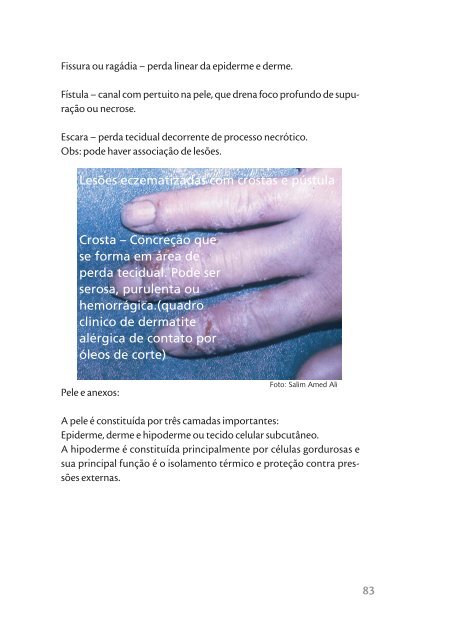 Dermatoses ocupacionais, 2006. - BVS Ministério da Saúde