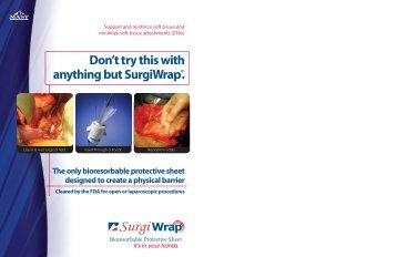 Don't try this with anything but SurgiWrap®. - MAST Biosurgery