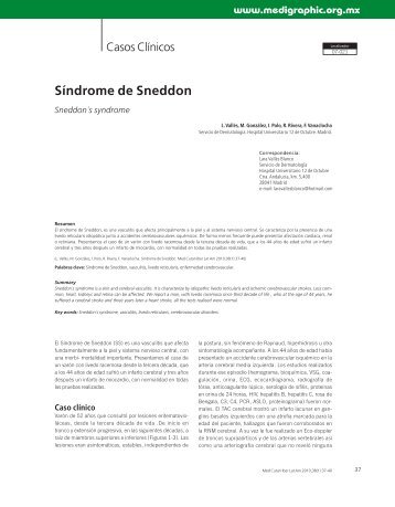 Síndrome de Sneddon - edigraphic.com