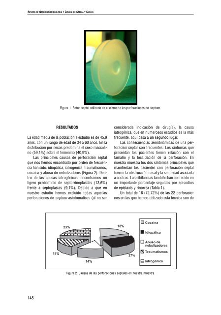 Utilidad del botón septal y nivel de satisfacción obtenido en los ...