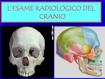 L'ESAME RADIOLOGICO DEL CRANIO - Etsrm.it