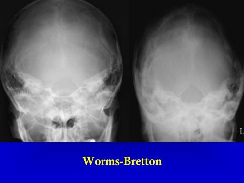 L'ESAME RADIOLOGICO DEL CRANIO - Etsrm.it