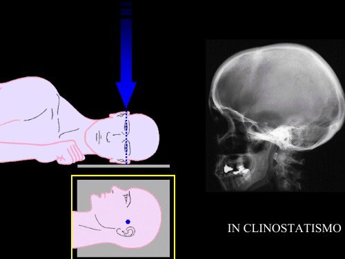 L'ESAME RADIOLOGICO DEL CRANIO - Etsrm.it