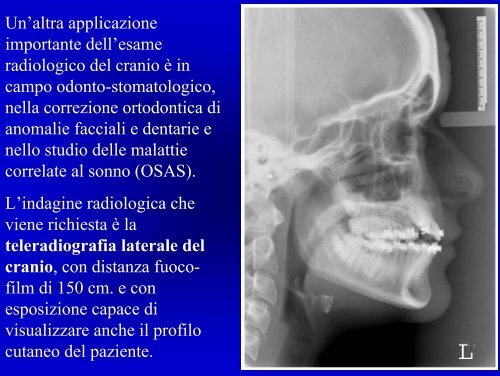 L'ESAME RADIOLOGICO DEL CRANIO - Etsrm.it