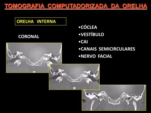 OSSOS TEMPORAIS(OUVIDO) - Comunidades