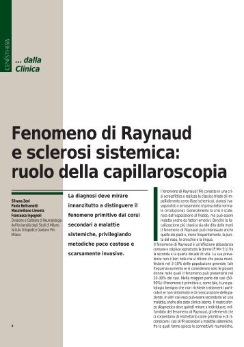 Fenomeno di Raynaud e sclerosi sistemica ... - Capillaroscopia.it