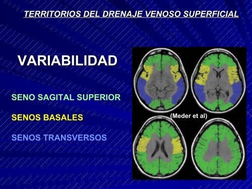 Resonancia Magnética . Ventajas. Anatomía Radiológica Normal ...