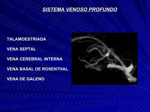 Resonancia Magnética . Ventajas. Anatomía Radiológica Normal ...