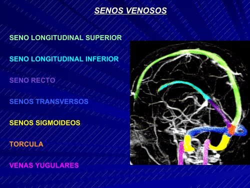 Resonancia Magnética . Ventajas. Anatomía Radiológica Normal ...